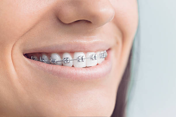 Best Dental Fillings (Composite and Amalgam)  in Lakefield, MN